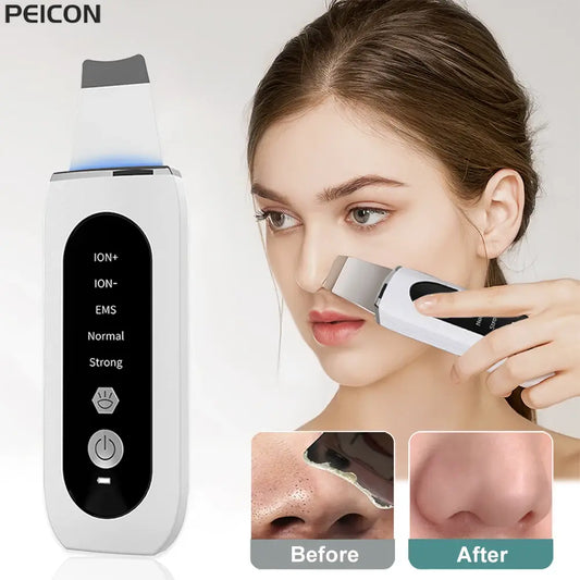 Your Health Plug - Ultrasonic Skin Scrubber Peeling Blackhead Remover Deep Face Cleaning